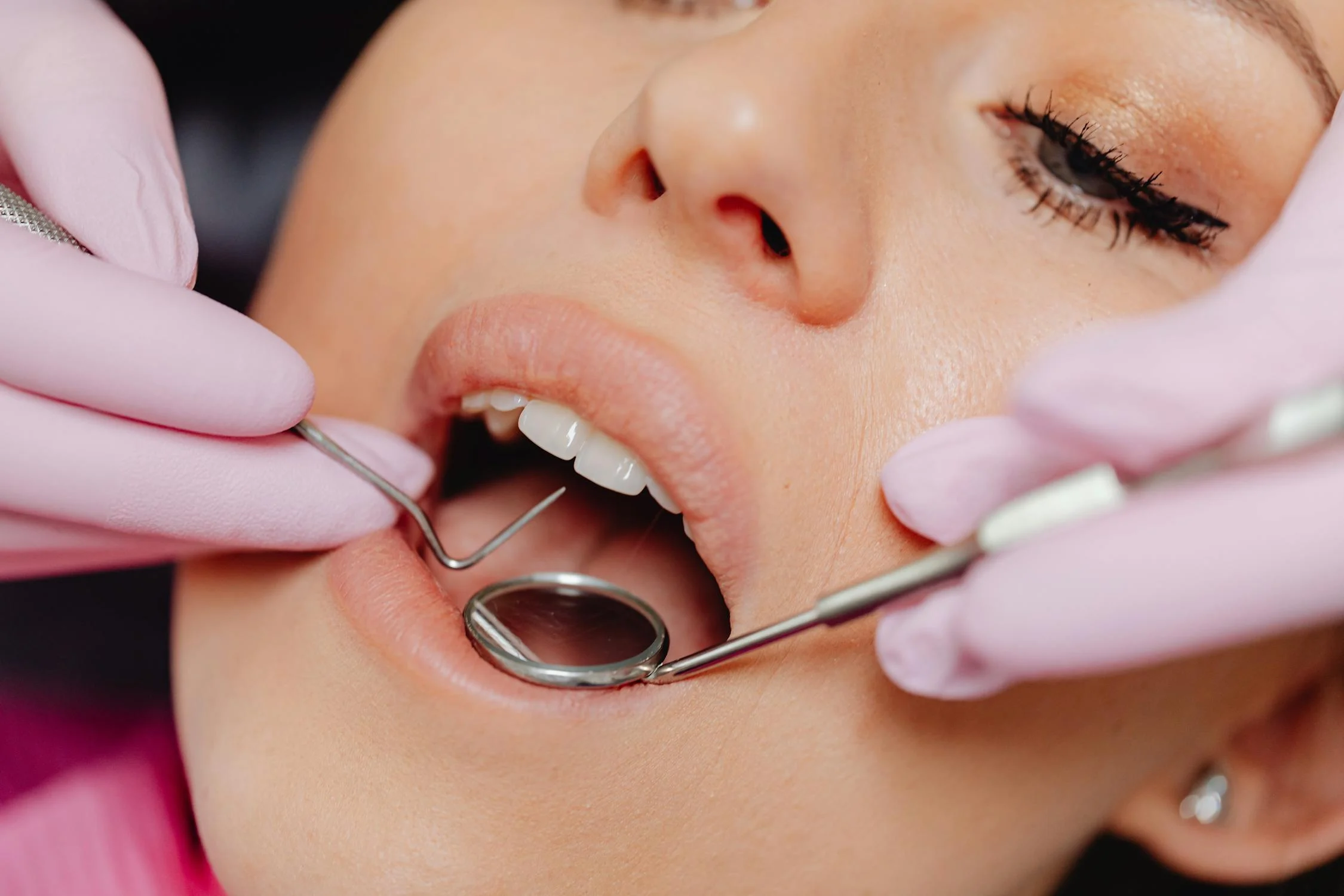 What is a Dental Crown?